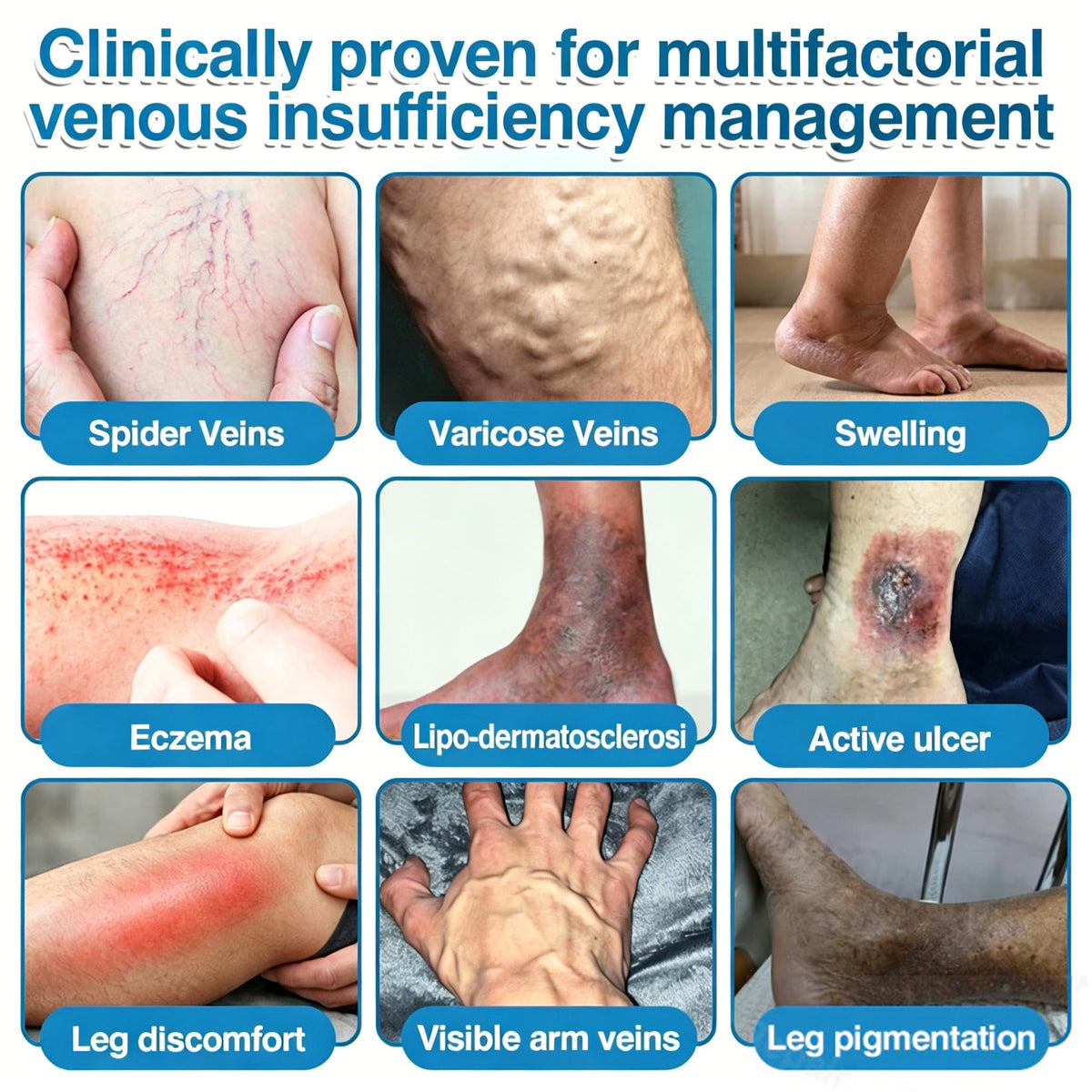 🇨🇦🏆✅️🏃Femscoop® VeinRepair Microneedle Patch Roll⚡Instant Relief, Long-Term Results
