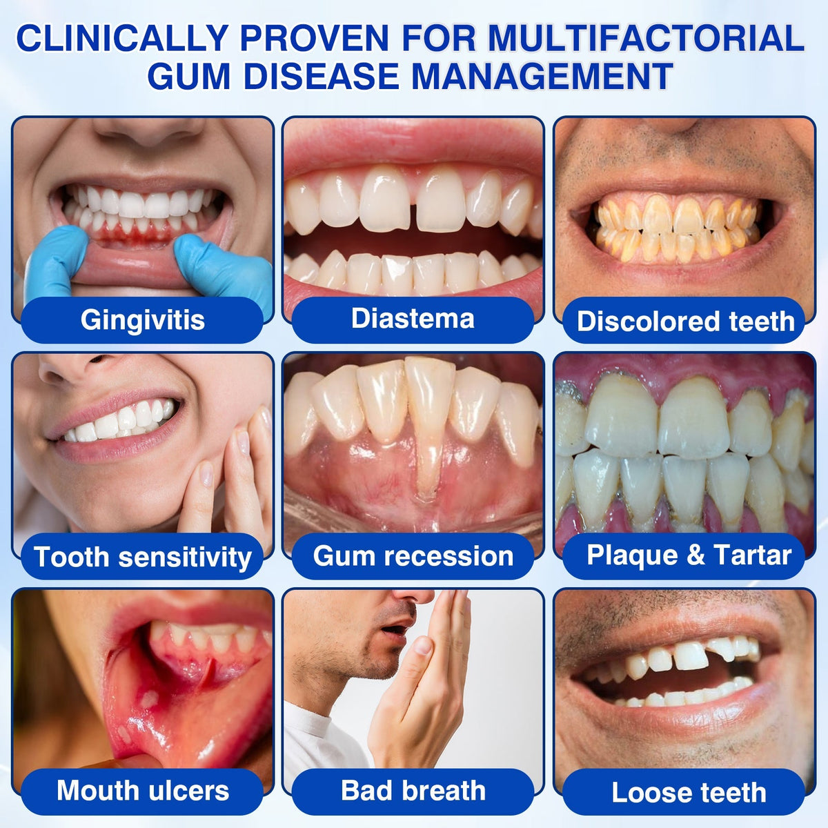 🇺🇸🏅🦷🛡️Selvitor® GumRevive Periodontal Repair Gel