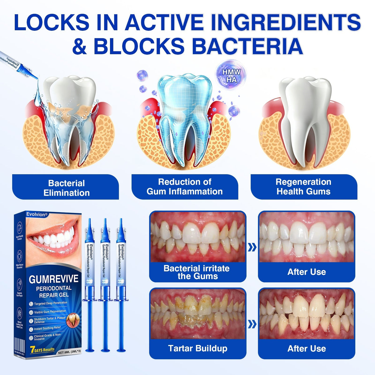 🇺🇸🏅🦷🛡️Selvitor® GumRevive Periodontal Repair Gel